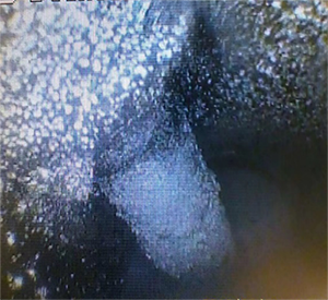 黑不溜秋的還有粉末狀，好惡心~  